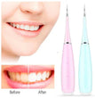 Portable Electric Sonic Dental Scaler UAE